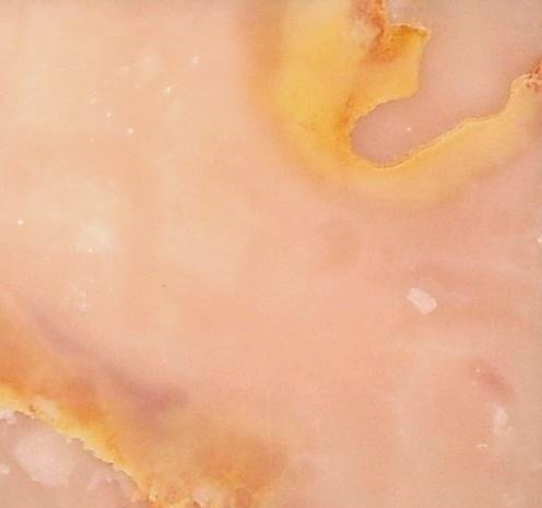 Pink Onyx (Иран)